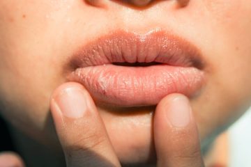 Ako prirodzene zväčšiť pery? – účinné a bezpečné metódy